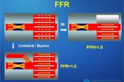 ffr智能算法 让你了解ffr智能算法的优势和应用