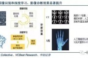 人工智能影像技术在医疗领域的应用及前景分析