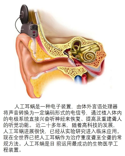 人工智能耳窝 探秘最新一代智能耳机技术
