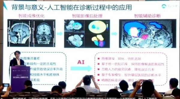 人工智能影像诊断 革新医学影像诊断的人工智能技术