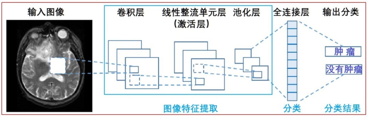 人工智能CT 计算机断层扫描技术在医学领域的应用