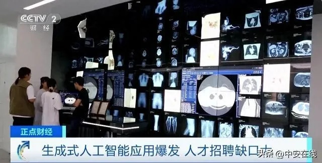 医学人工智能公司招聘 寻找有志于医疗AI领域的人才